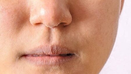 Yanlış eserler cildinizi kurutuyor olabilir! İşte hakikat seçimler!